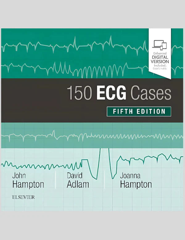 150 ECG Cases, 5th Edition - Multicolor Glossy Paper